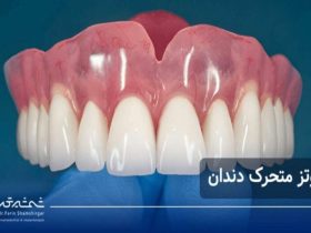 پروتز متحرک دندان
