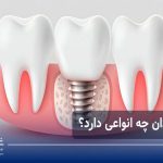 انواع پروتز دندان