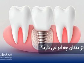 انواع پروتز دندان