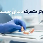 پروتز متحرک دندان چیست؟