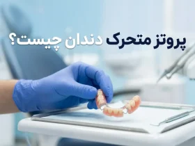 پروتز متحرک دندان چیست؟