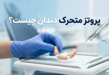 پروتز متحرک دندان چیست؟