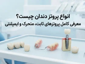 انواع پروتز دندان چیست