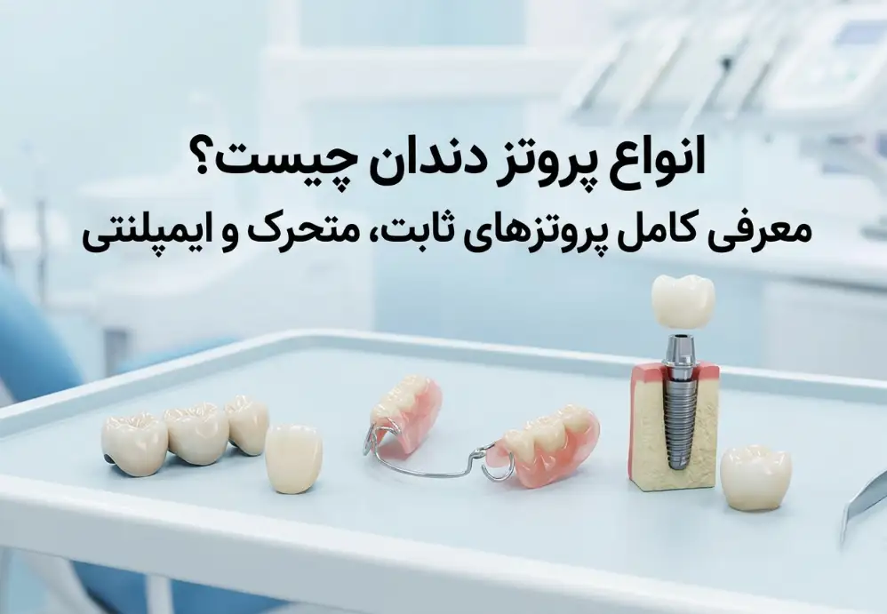 انواع پروتز دندان چیست