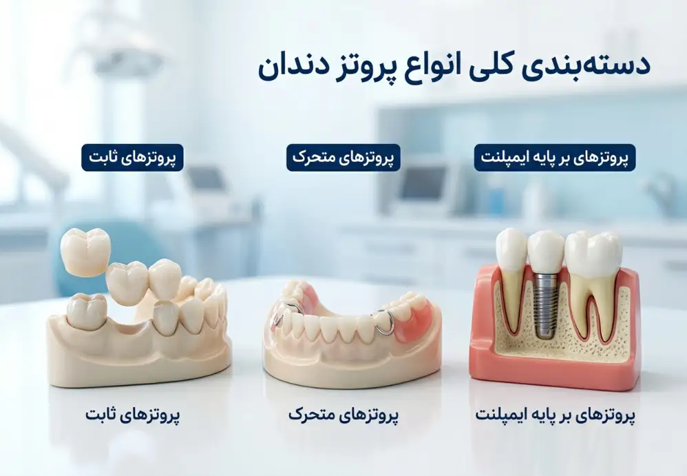 دسته‌بندی کلی انواع پروتز دندان