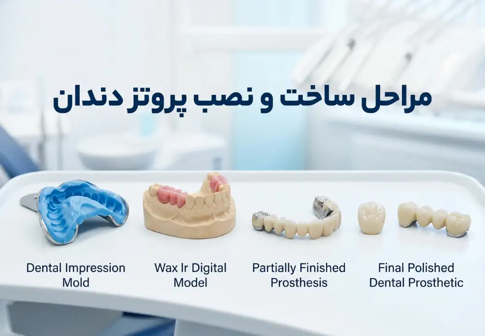 مراحل ساخت و نصب پروتز دندان