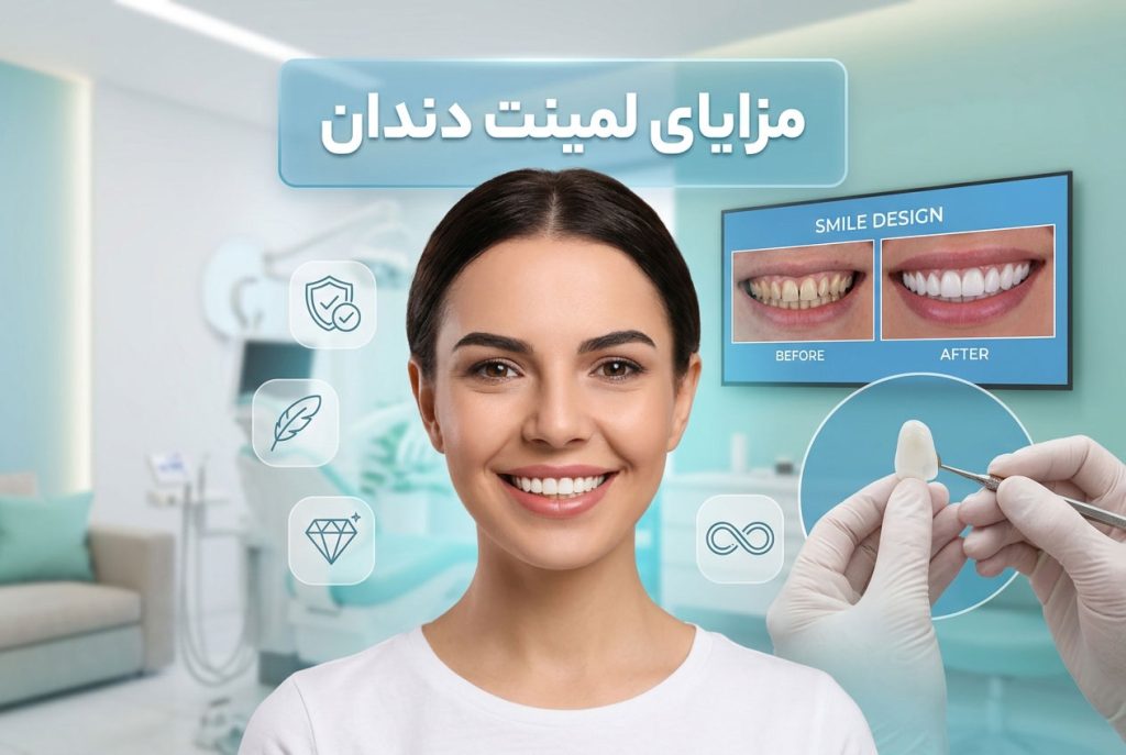 مزایای لمینت دندان