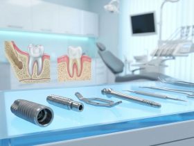 انواع ایمپلنت دندان