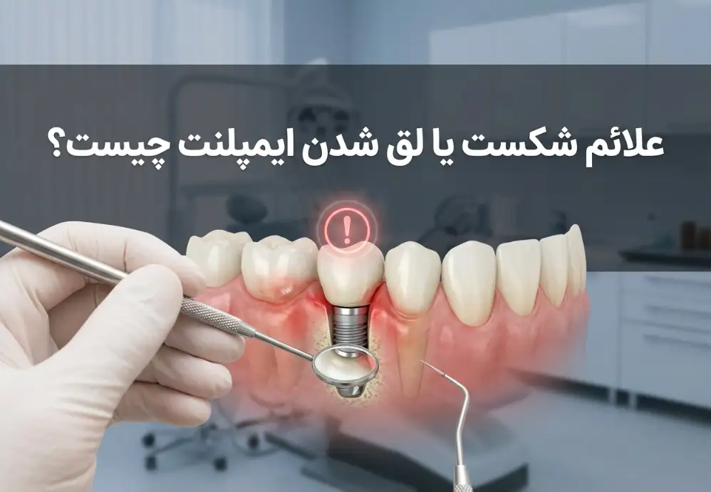 علائم شکست یا لق شدن ایمپلنت چیست؟