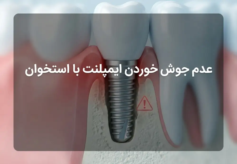 عدم جوش خوردن ایمپلنت با استخوان