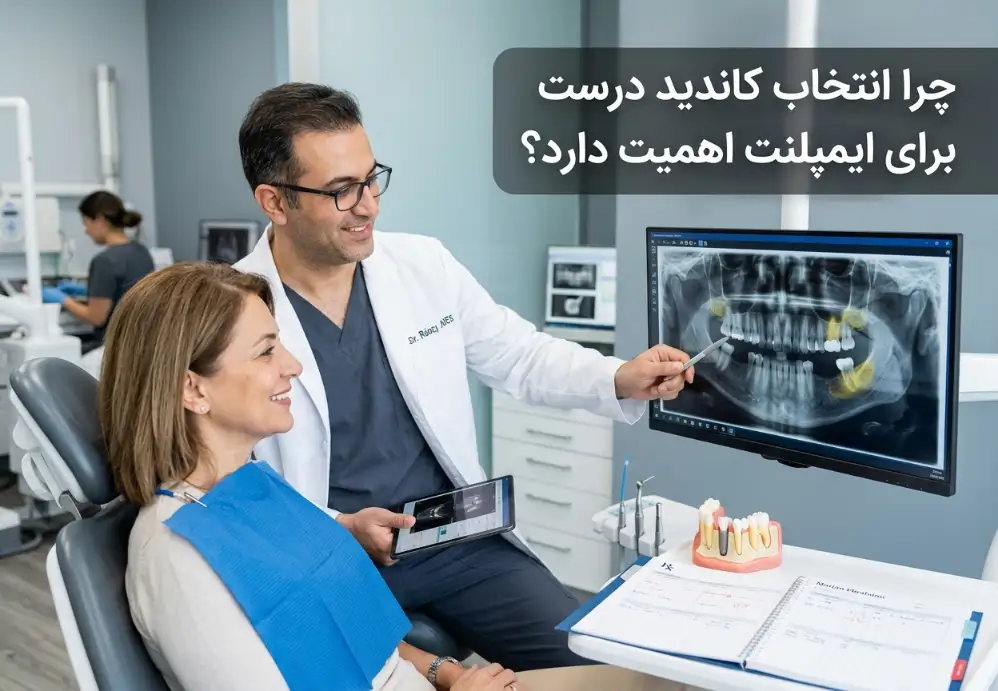 چرا انتخاب کاندید درست برای ایمپلنت اهمیت دارد؟