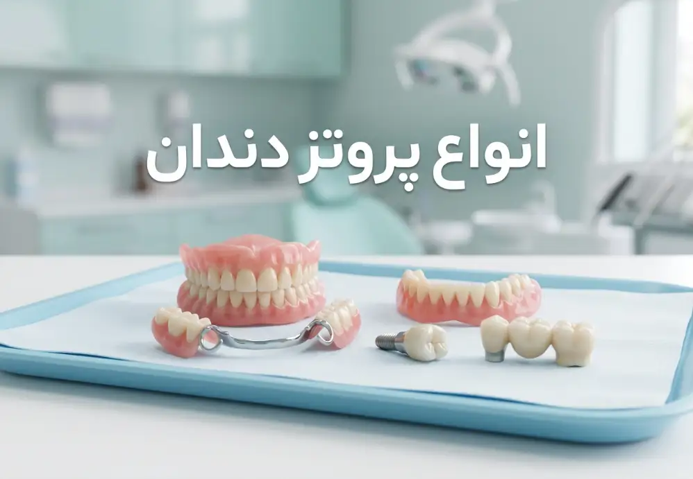 انواع پروتز دندان