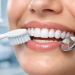 مراقبت از ونیر کامپوزیت دندان