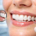 طول عمر کامپوزیت دندان چقدر است