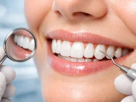 طول عمر کامپوزیت دندان چقدر است