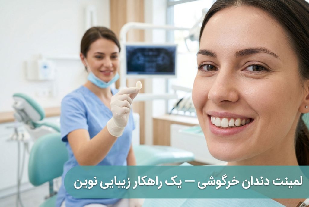 لمینت دندان خرگوشی — یک راهکار زیبایی نوین