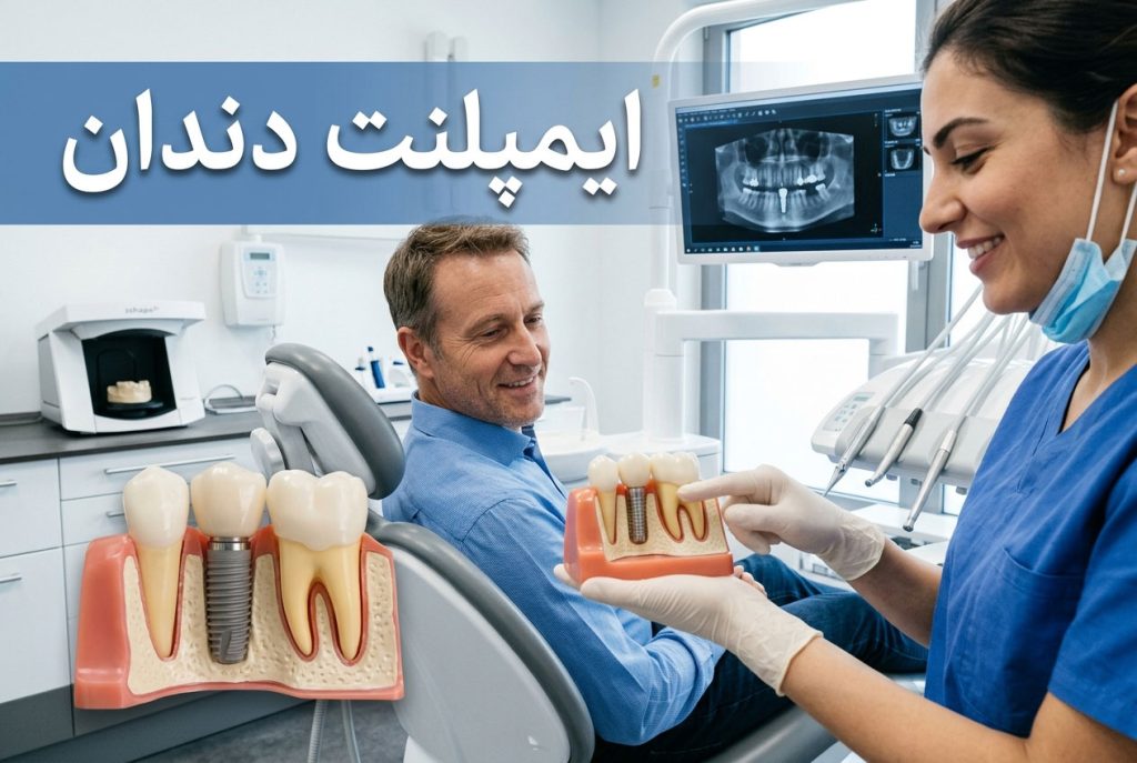 ایمپلنت دندان