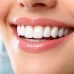 لمینت دندان خرگوشی