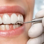 طول عمر ایمپلنت دندان چقدر است