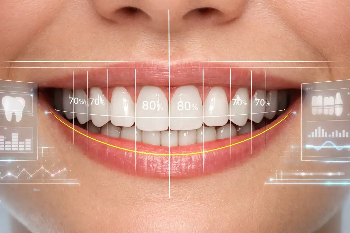 آنالیز طراحی لبخند چیست