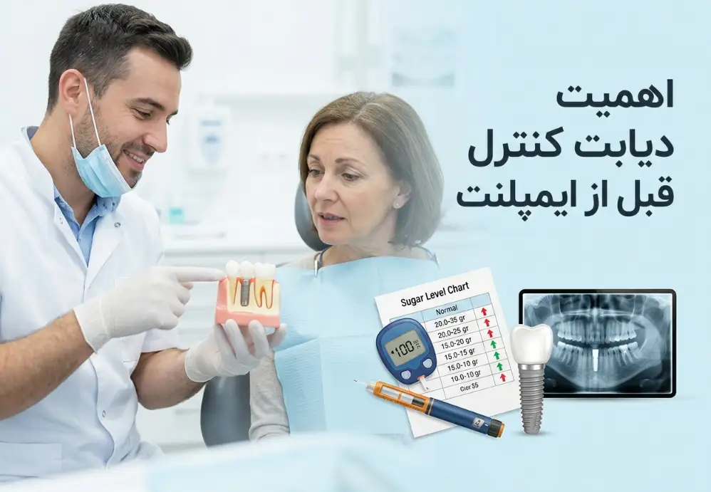 اهمیت کنترل دیابت قبل از ایمپلنت