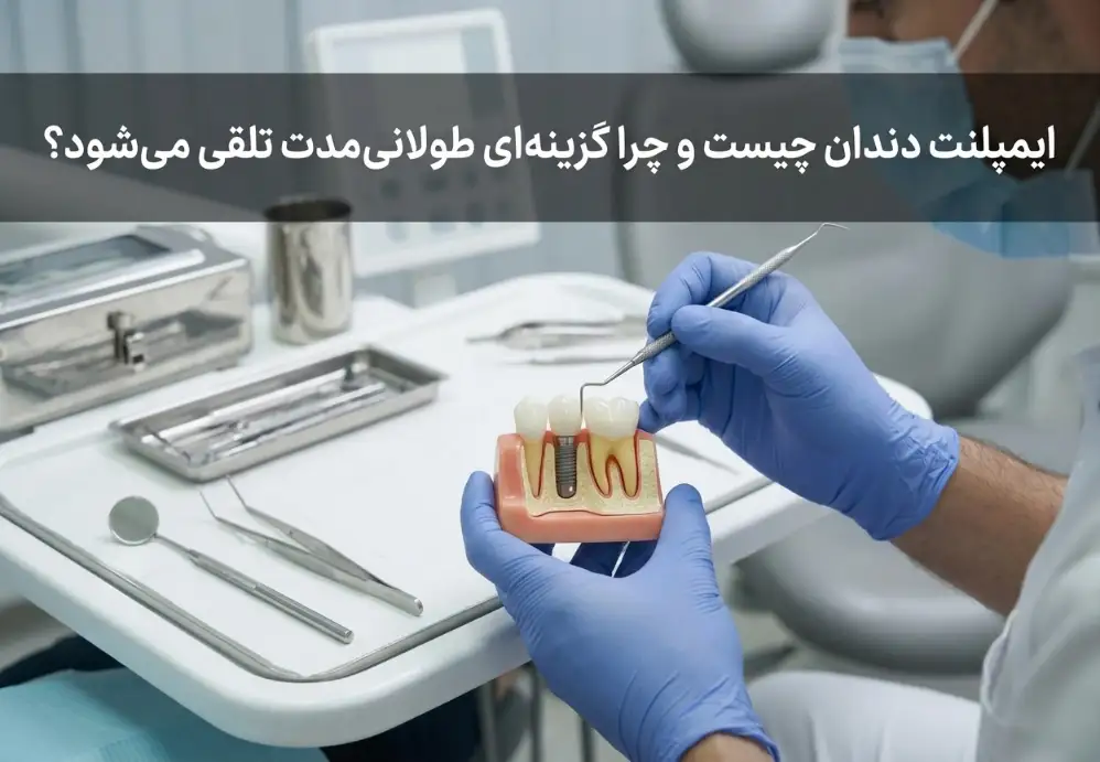 ایمپلنت دندان چیست و چرا گزینه‌ای طولانی‌مدت تلقی می‌شود؟