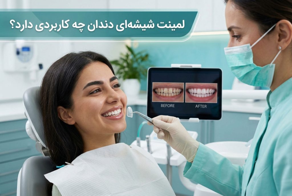 لمینت شیشه‌ای دندان چه کاربردی دارد؟