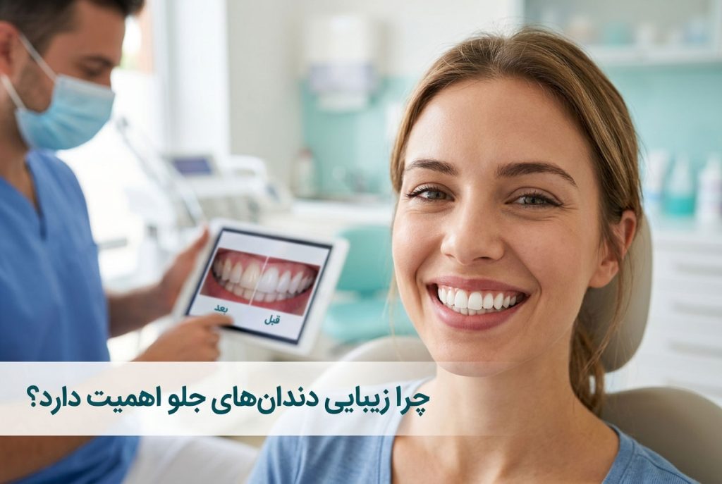 چرا زیبایی دندان‌های جلو اهمیت دارد؟