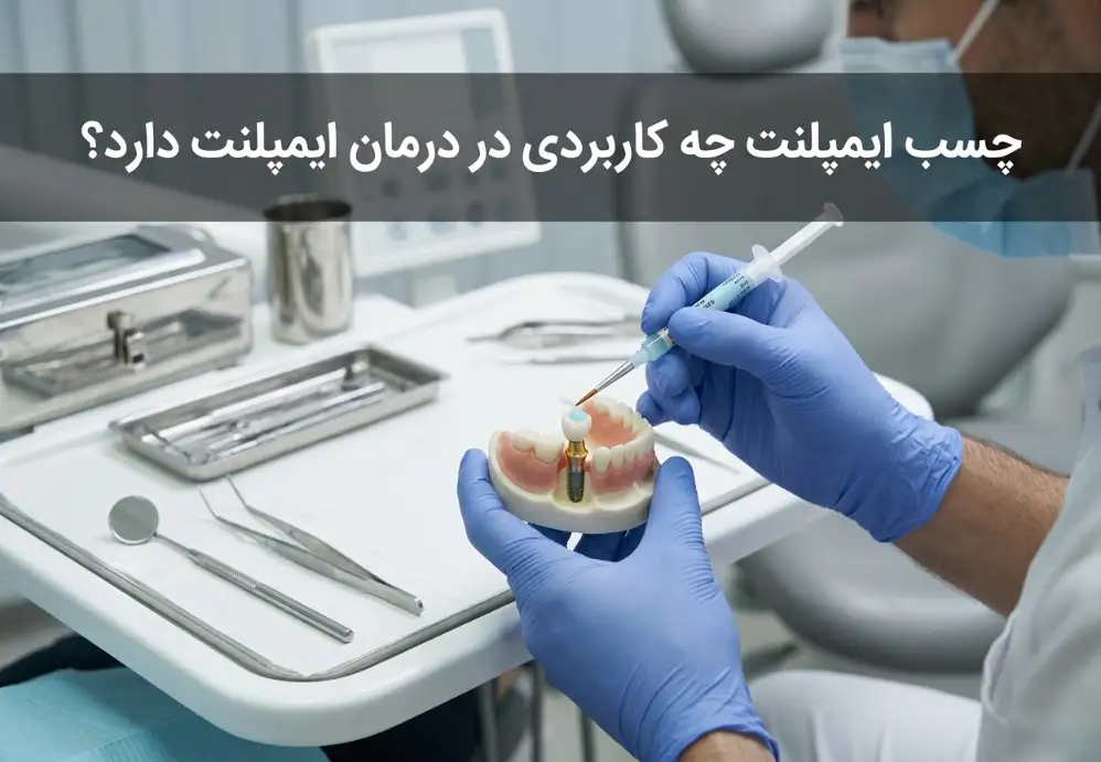 چسب ایمپلنت چه کاربردی در درمان ایمپلنت دارد؟
