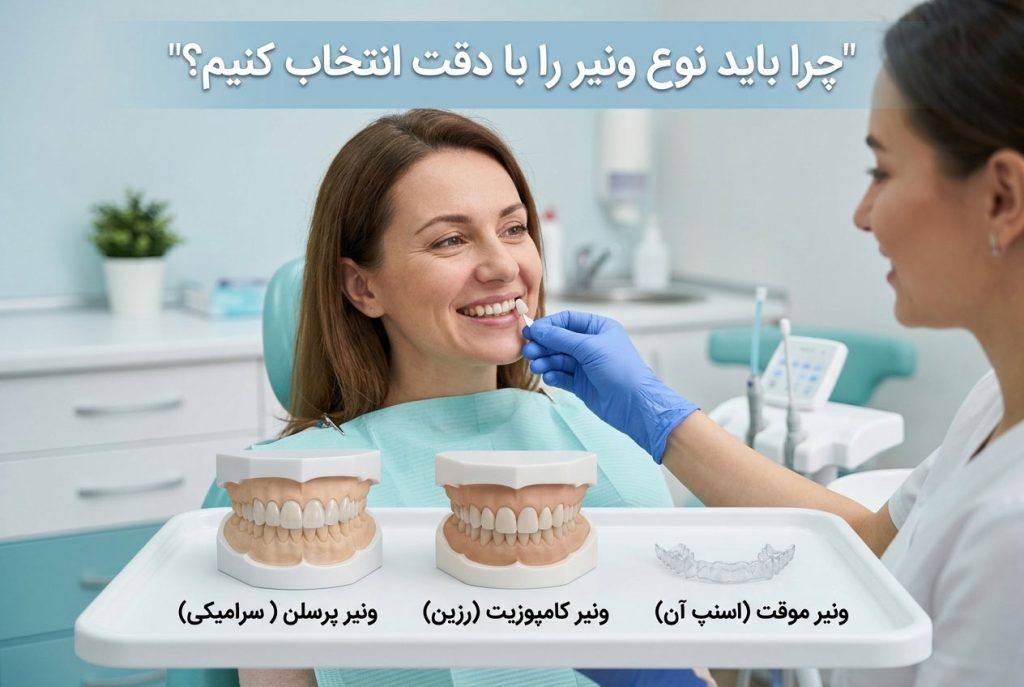 چرا باید نوع ونیر را با دقت انتخاب کنیم؟