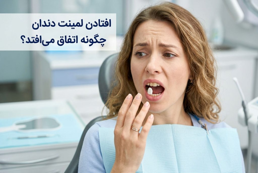 افتادن لمینت دندان چگونه اتفاق می‌افتد؟