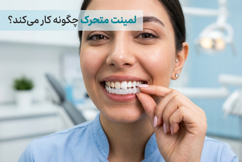 لمینت متحرک چگونه کار می‌کند؟