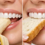 غذا خوردن با لمینت دندان