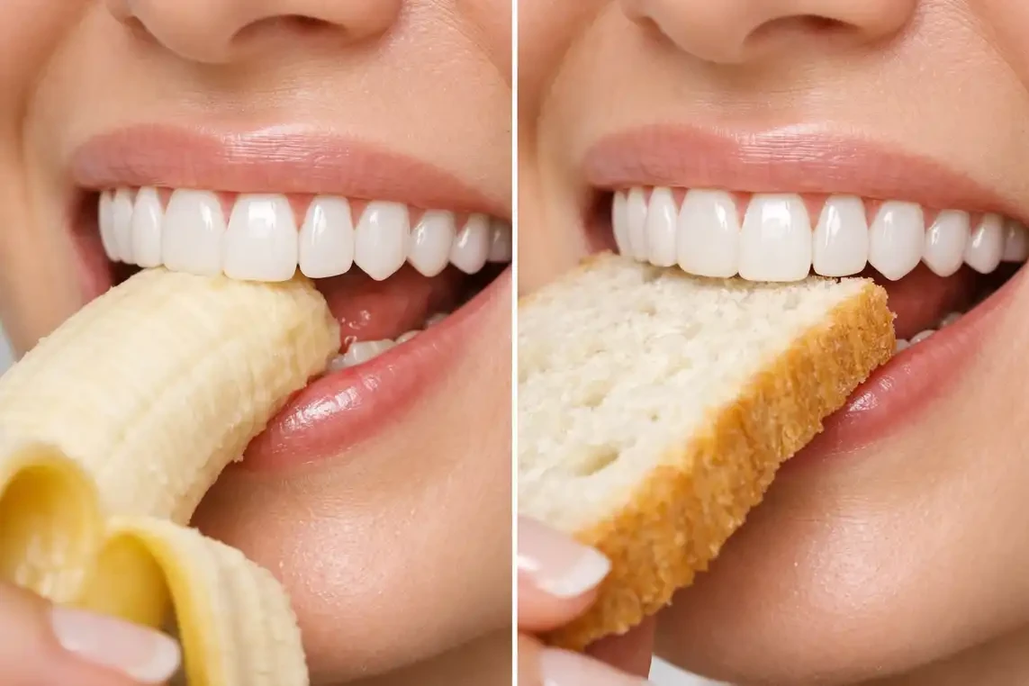 غذا خوردن با لمینت دندان