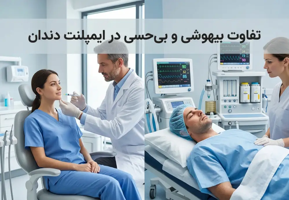 تفاوت بیهوشی و بی‌حسی در ایمپلنت دندان