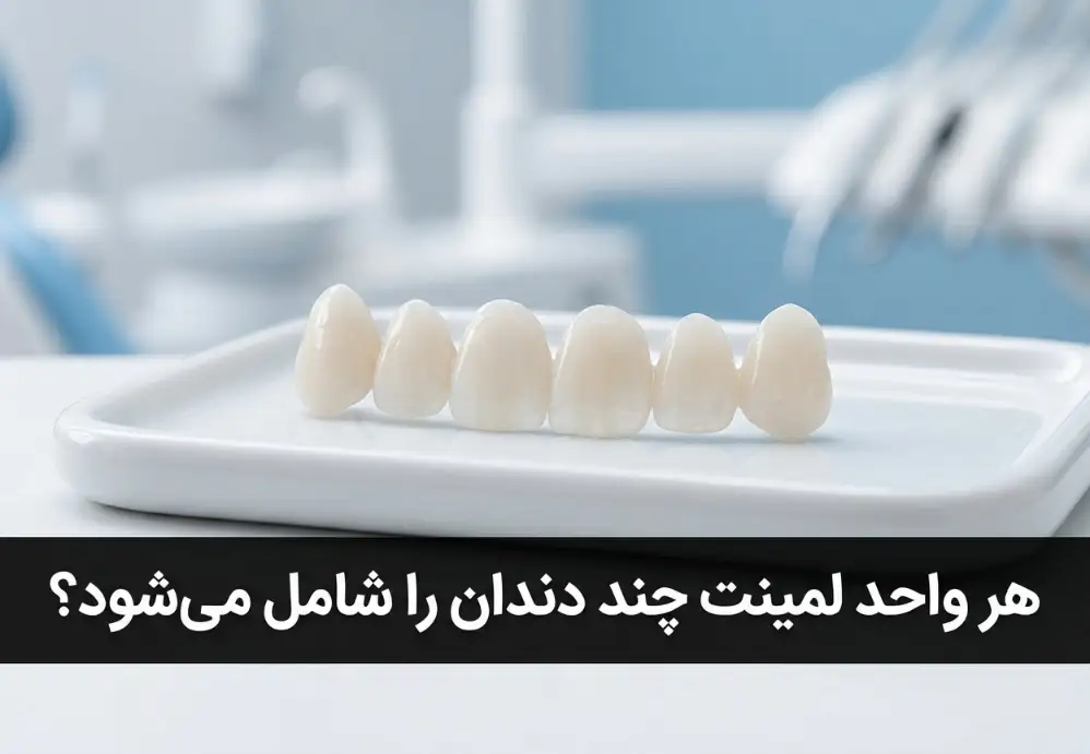 هر واحد لمینت چند دندان را شامل می‌شود؟