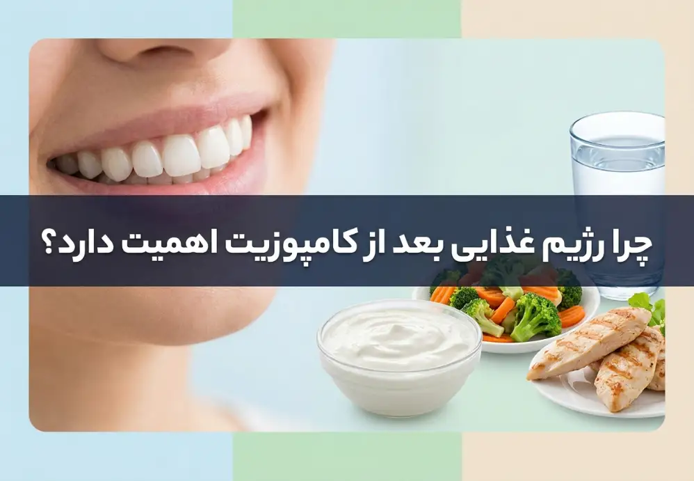 چرا رژیم غذایی بعد از کامپوزیت اهمیت دارد؟