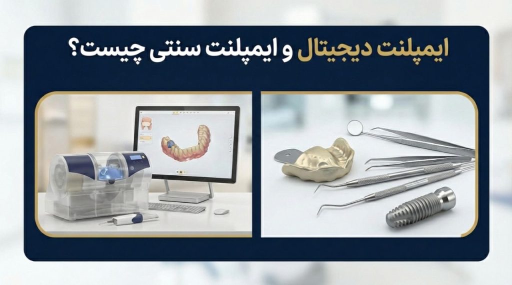 ایمپلنت دیجیتال و ایمپلنت سنتی چیست