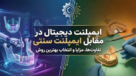 ایمپلنت دیجیتال در مقابل ایمپلنت سنتی
