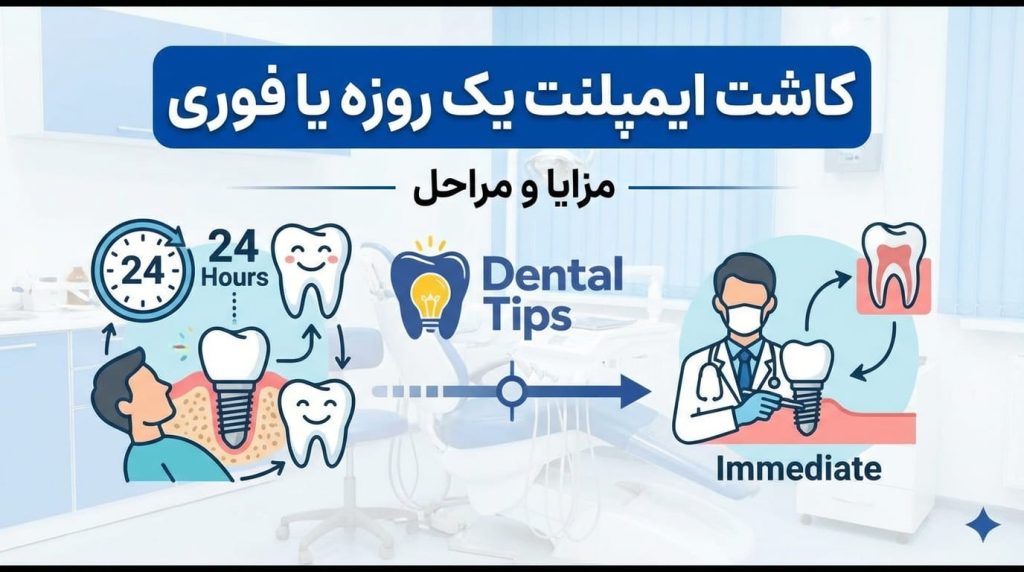 ایمپلمنت یک روزه