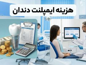 هزینه ایمپلنت در ایران