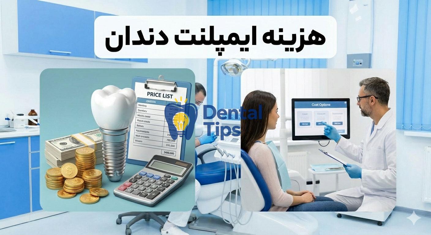 هزینه ایمپلنت در ایران