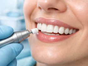 چگونه کامپوزیت دندان را سفید کنیم