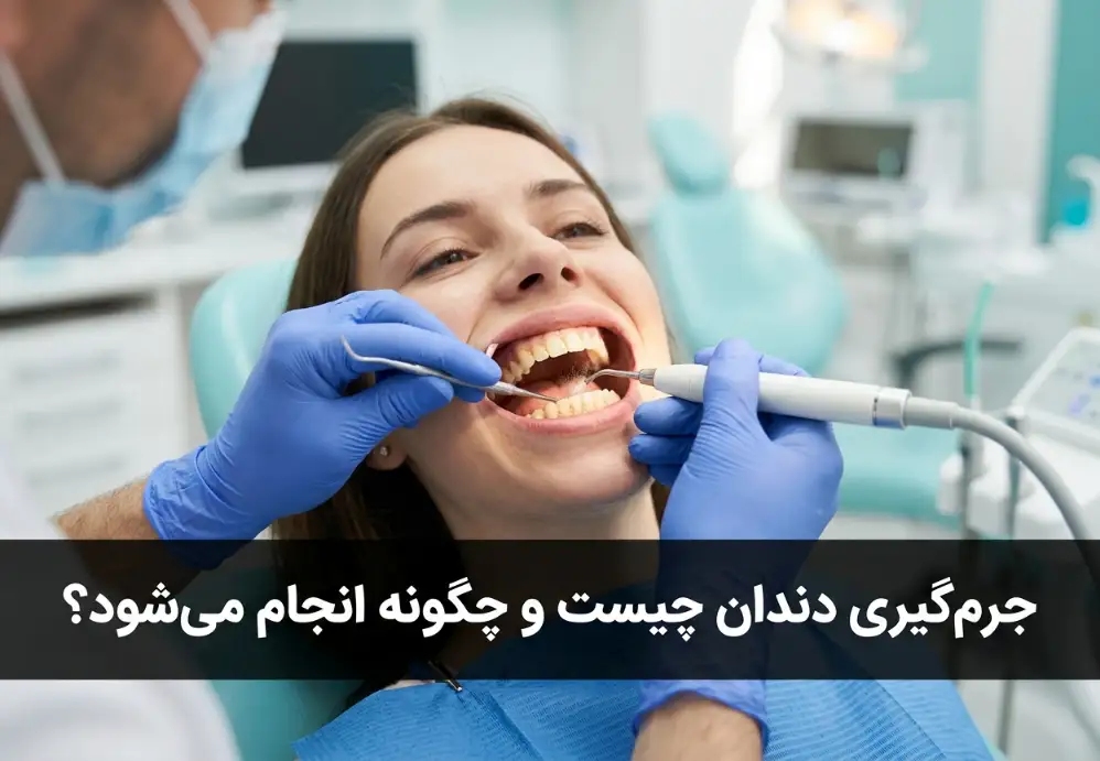 جرم‌گیری دندان چیست و چگونه انجام می‌شود؟