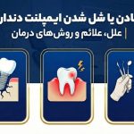 افتادن یا شل شدن ایمپلنت دندان