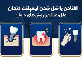 افتادن یا شل شدن ایمپلنت دندان
