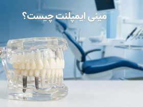 مینی ایمپلنت چیست