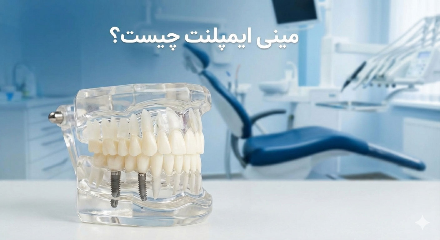 مینی ایمپلنت چیست