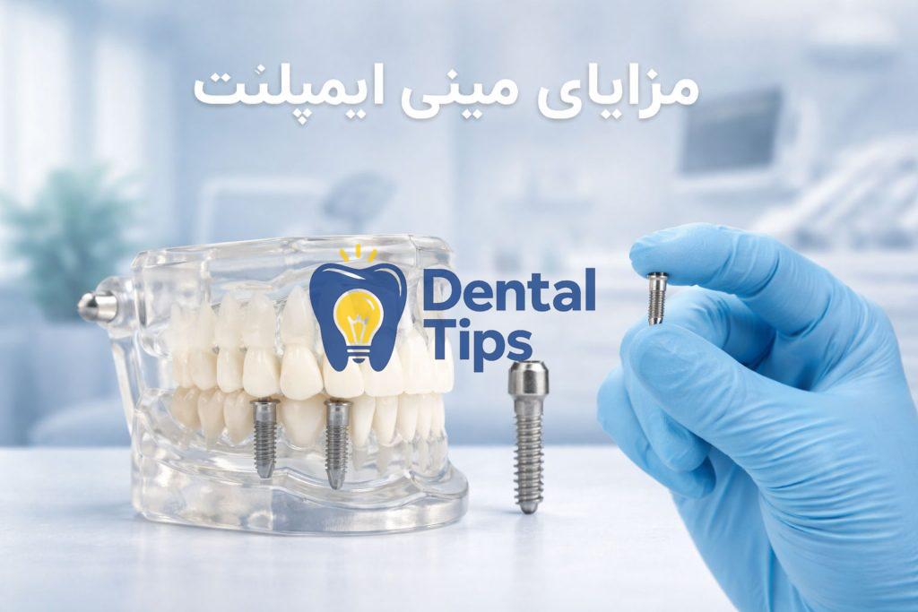 مزایای مینی ایمپلنت