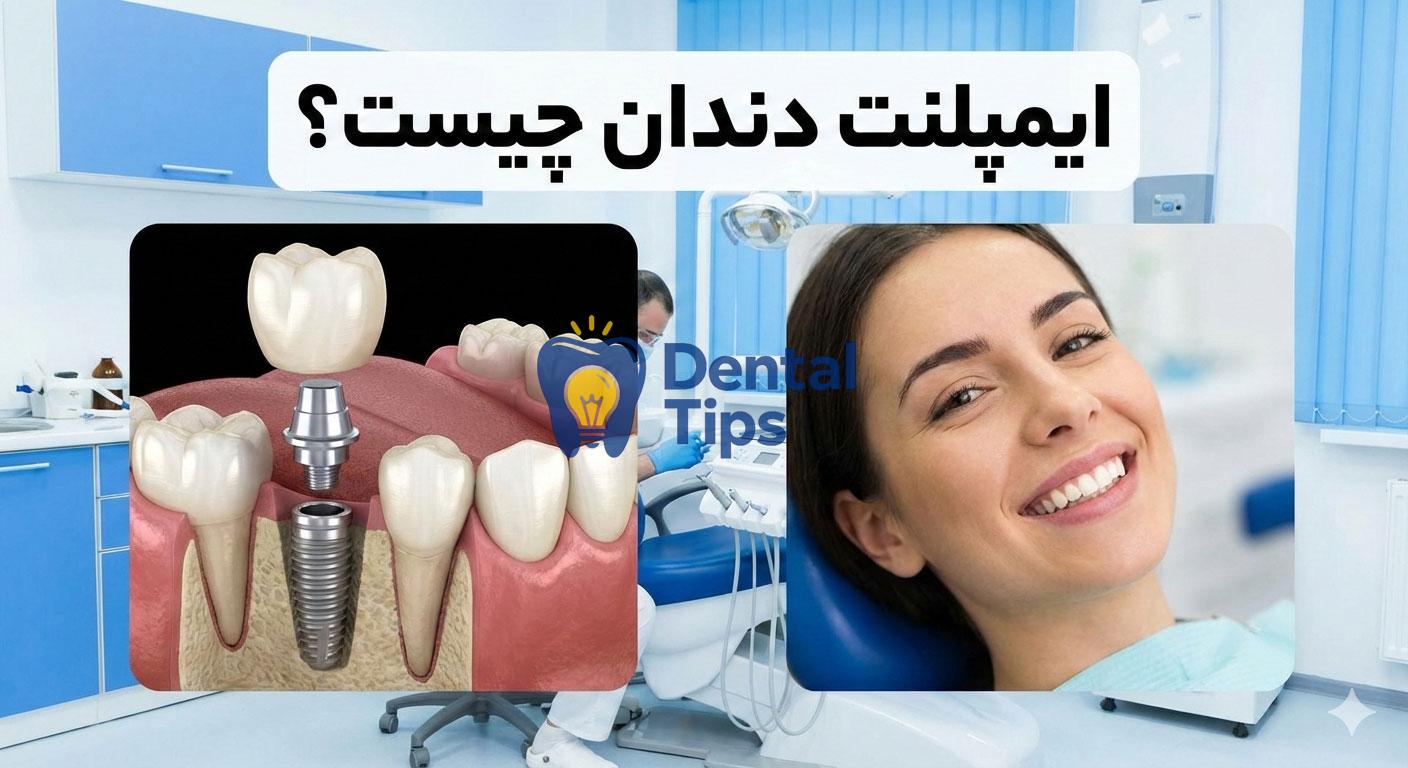ایمپلنت دندان